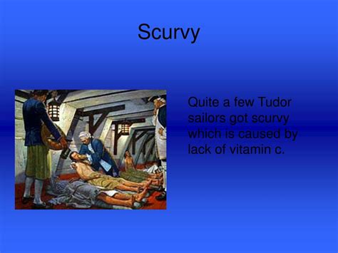 tudor sailor scurvy.